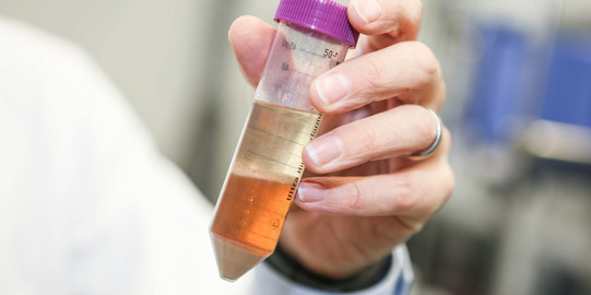 A sample vessel with a liquid in light yellow color in the laboratory.