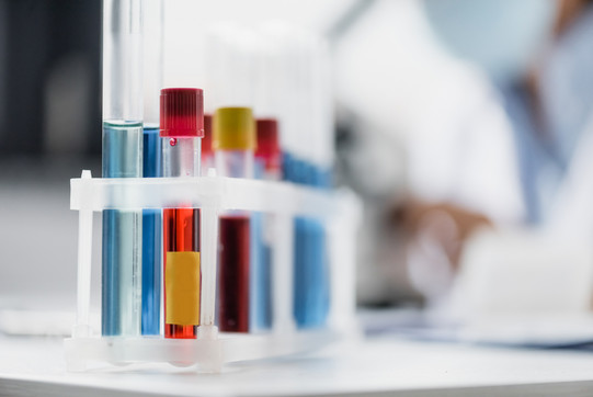 A set of test tubes filled with various red and blue liquids.