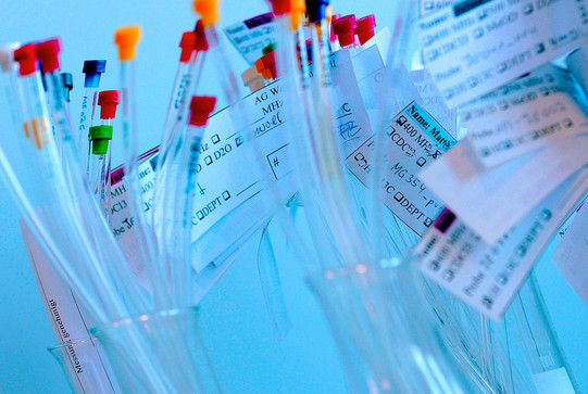 Glass tubes with colored lids to which slips of paper are attached stand in beakers.