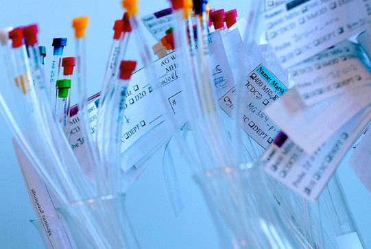 Glass tubes with colored lids to which slips of paper are attached stand in beakers.